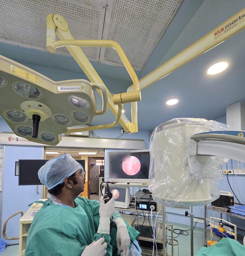 Surgeon performing RIRS for a kidney stone, watching the endoscopic view on a monitor in the operating theatre